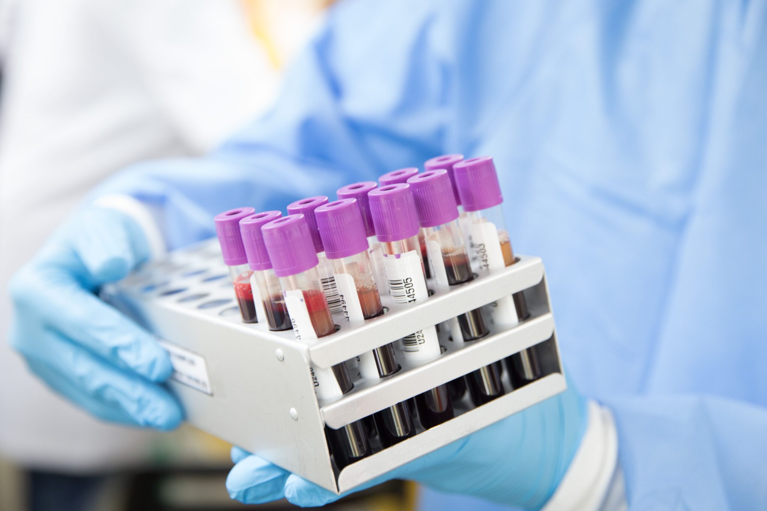 analyses laboratoire