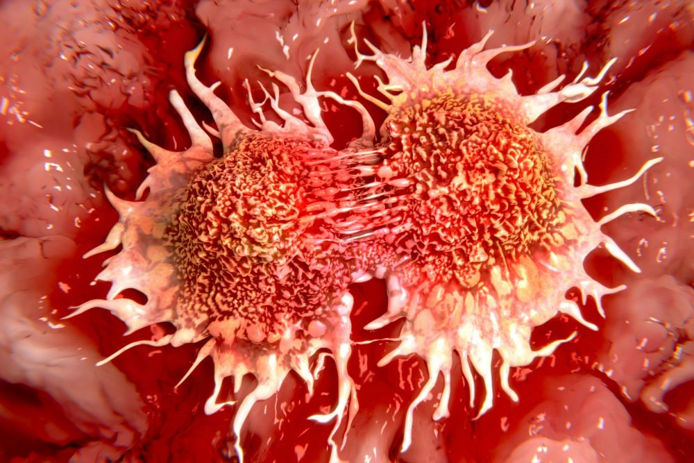 Krebszellen (Prostatakrebs) im Zeilteilungsprozess Canva Tumor, neues KI-Modell,